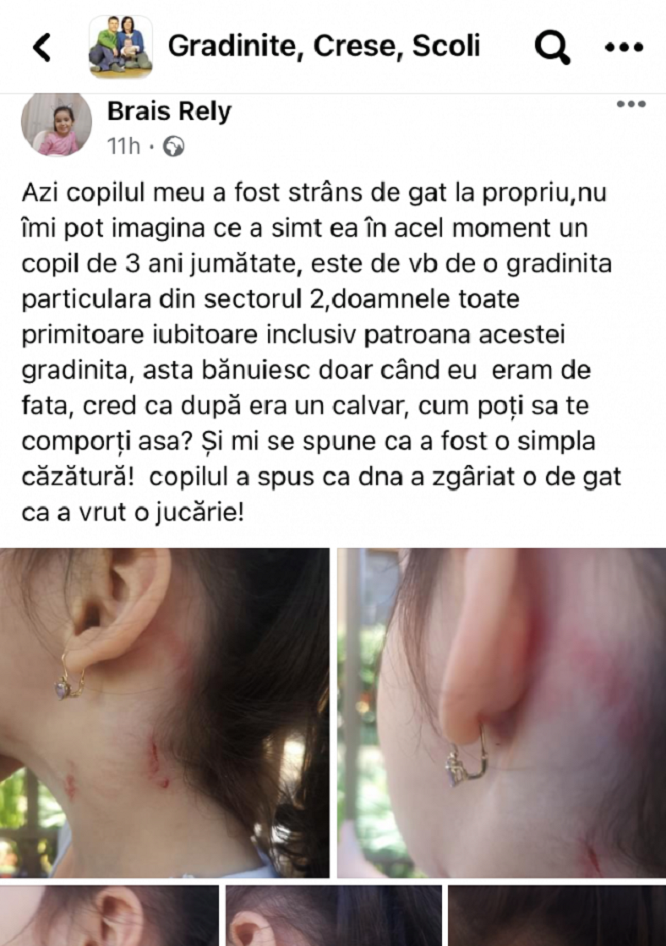 Fetiţă de 3 ani rănită la o grădiniţă privată