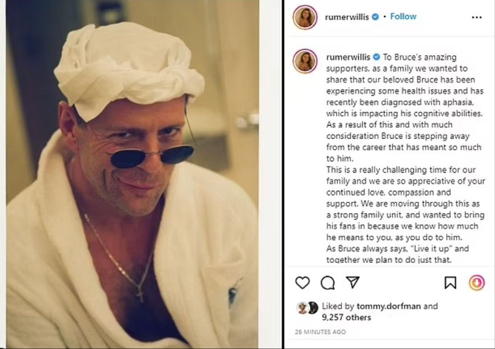 Bruce Willis, diagnosticat cu o afecțiune gravă a creierului. Actorul de 67 de ani renunță la actorie