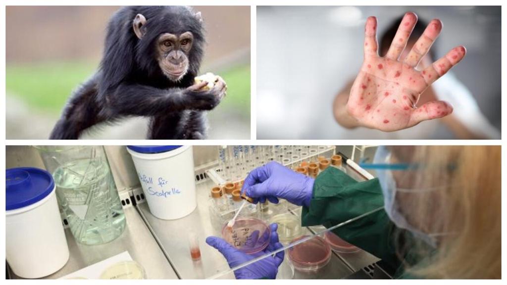 Variola maimuţei se extinde, OMS anunţă oficial peste 5000 de cazuri