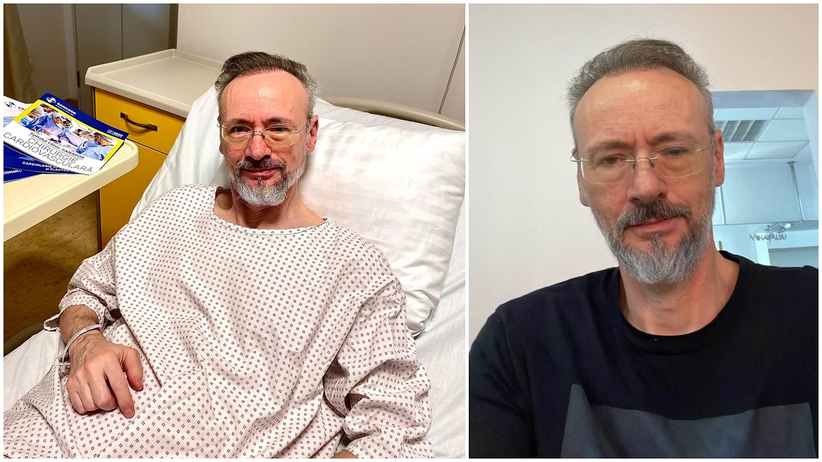 Cum se simte Mihai Albu după ce a fost diagnosticat cu cancer: „E ok, totul e sub control”
