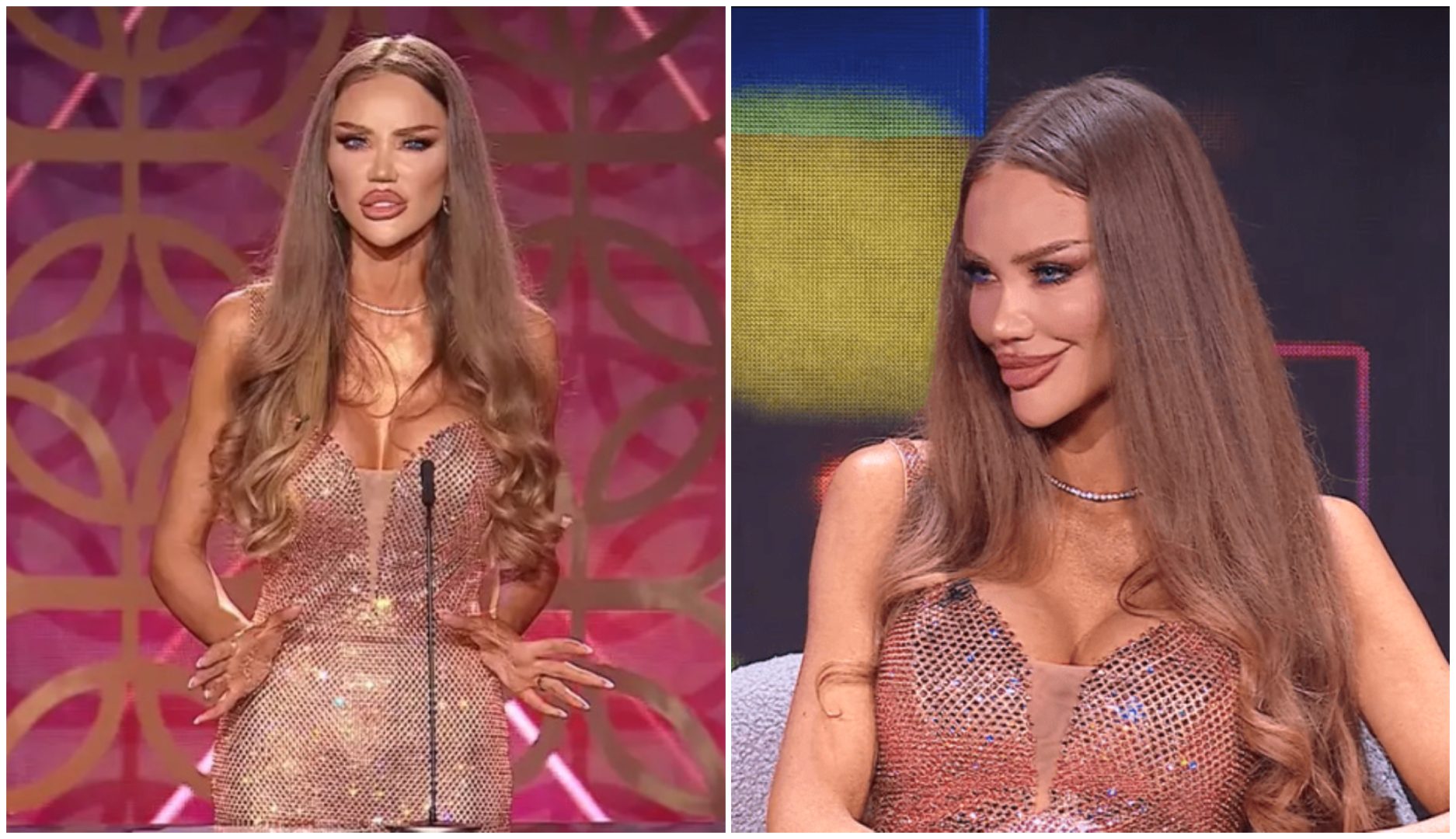 Bianca Drăgușanu, schimbată complet la față. Motivul pentru care are bărbia atât de ascuțită: „Multă lume e deranjată de aspectul meu”