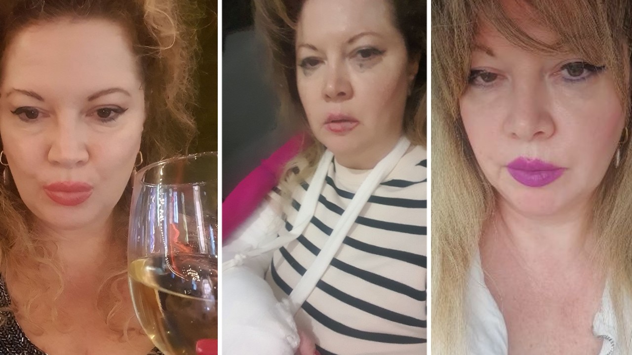 Oana Lis a ajuns de urgență la spital, după ce a căzut pe stradă. Vedeta este distrusă: „Groaznic, trăiesc o dramă. Mă gândesc numai la Viorel”