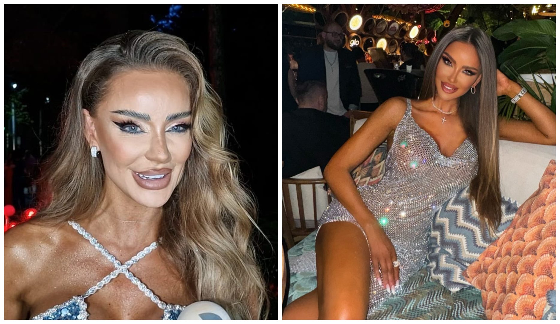 Bianca Drăgușanu se pregătește pentru o nouă intervenție estetică. De data asta vrea să micșoreze: „Efectiv mi se pare că sunt foarte urâtă”