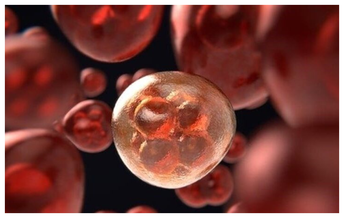 Bolnavii de leucemie au o nouă speranță. Cercetătorii au descoperit un tratament care omoară celulele canceroase