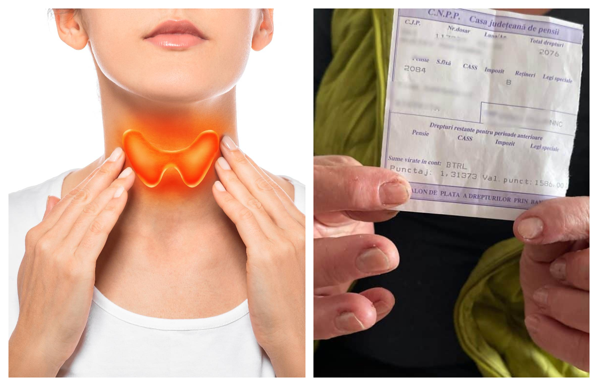 În ce condiții poate obține pensie de handicap românii cu tiroidă autoimună. Ce spune legea