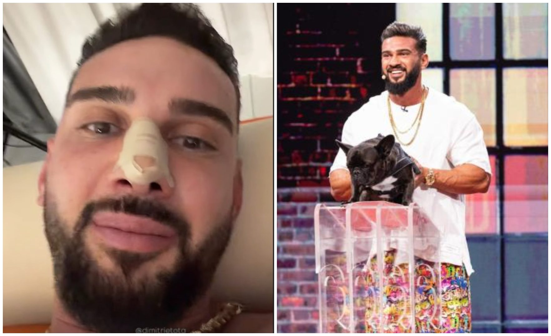 Cum arată nasul lui Dorian Popa după operație. Influencerul și-a dat bandajele jos: „Cum nici nu am visat. O respirație impecabilă”