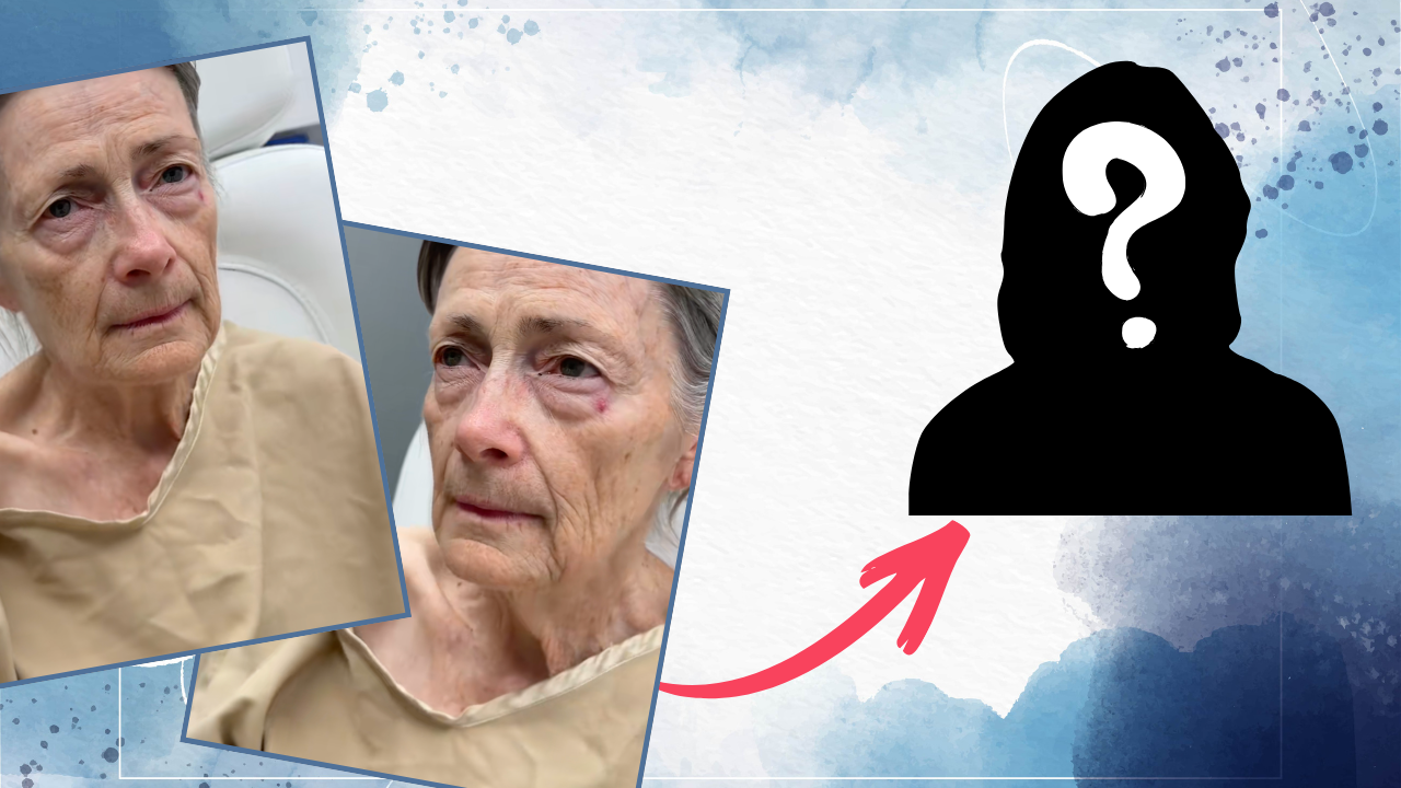 Transformarea incredibilă a unei femei de 70 de ani după un facelift! A plâns de fericire în brațele medicului: „Când oamenii mă întreabă câți ani am, o să spun 40”