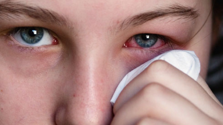 Și tu folosești ceai de mușețel în zona ochilor? Medicii trag un semnal de alarmă: „Nu este bun pentru dezinfectarea suprafeței oculare”