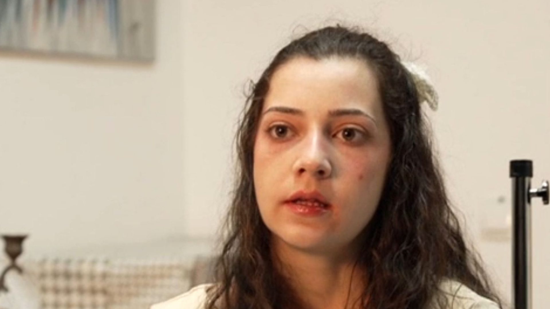 Tânăra care a vrut „să moară frumoasă”. Povestea Noeliei, care a fost eutanasiată astăzi, la doar 25 de ani