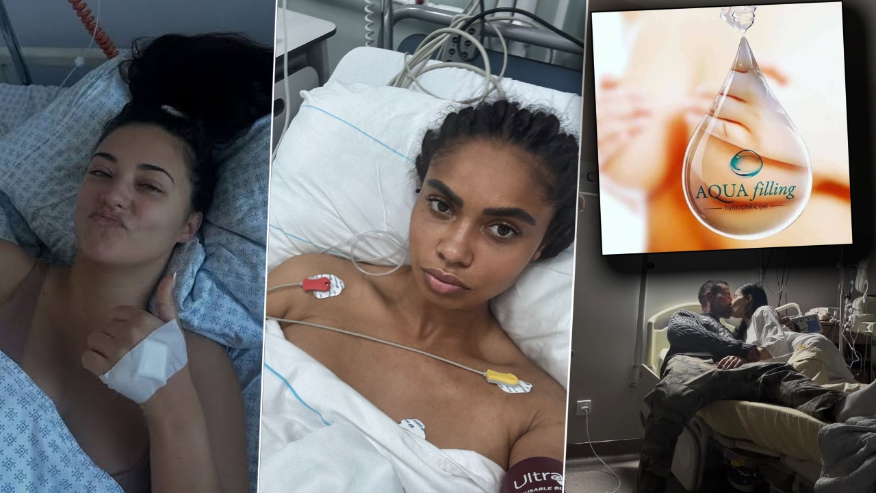 Semnalul de alarmă tras de un medic privind injectarea cu Aquafilling, intervenție estetică la care au apelat Antonia, Andreea Sasu și Laurette