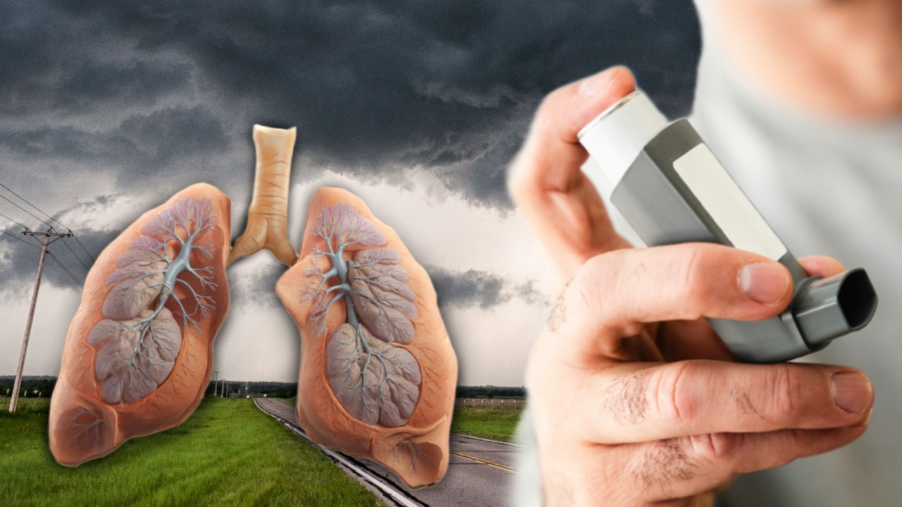 Ce este astmul de furtună. Fenomenul respirator favorizat de schimbările climatice bruște